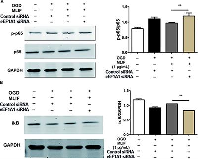 MLIF Modulates Microglia Polarization in Ischemic Stroke by Targeting eEF1A1